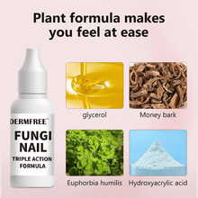 Load image into Gallery viewer, Toenail Fungus Treatment Extra Strength